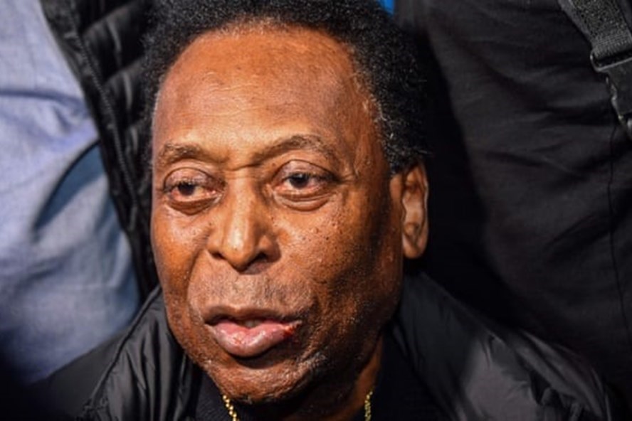 Vua bong da Pele nhap vien khan cap, nguoi ham mo Brazil lo lang hinh anh 1