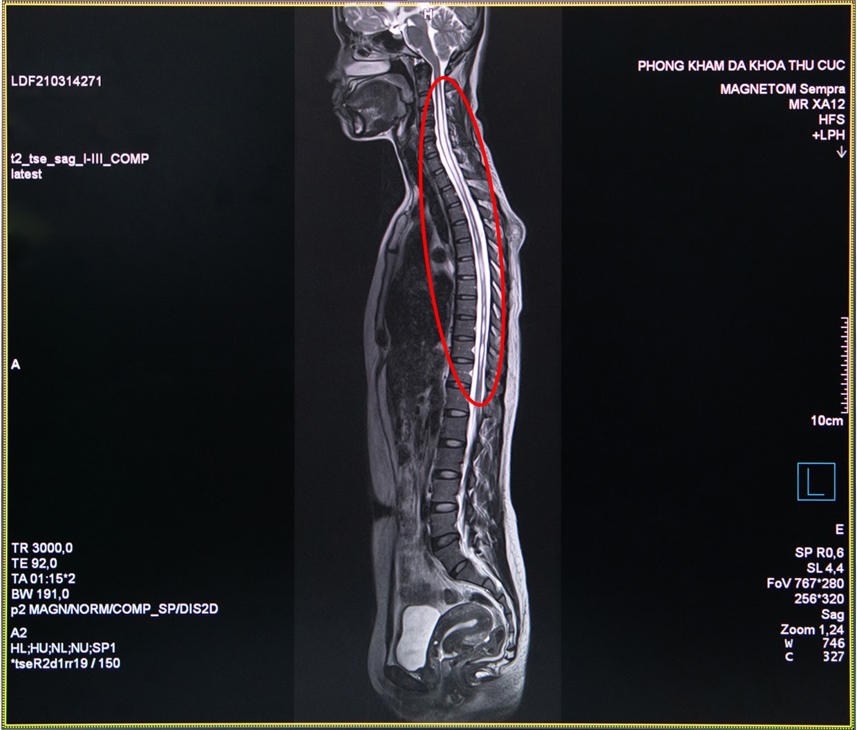Description: https://lh5.googleusercontent.com/mf3BHiTUL9Al9qUDLPMmwA5EfaVlbMuO3bjsS4V74QcSMsaa-bAJadNltRZ2CHLeDs60rmB9Q14qRm_rGjEw8s0RjmKWqYLkWMPZFyrsXuwdfRMnwr3sbPIDHDiPdJwdKg