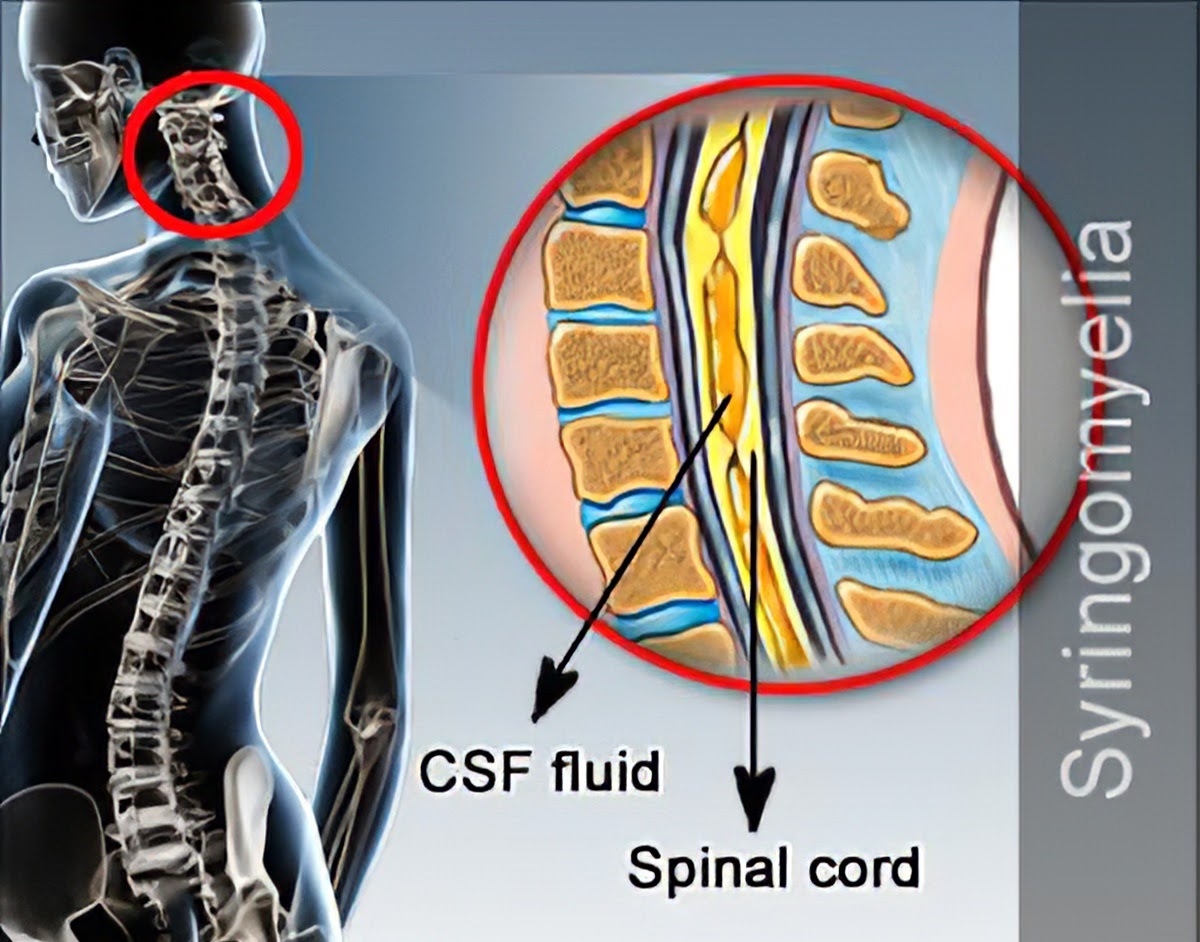 Description: https://lh4.googleusercontent.com/ly1sTP9xSWqNJkjf2KcRdskXpHT6dRRLiYjmJNw43XwDrjmjbPt3xLwdyLPeis_fymypwT1D0xShUpdNdLig1_yv3jgWQK0Rd2KdX7lEBjqb9MNc4ArFfMEhsu1FomjAyw